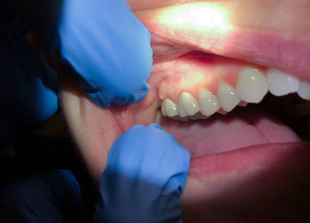 Best Cosmetic Emergency Dentistry in Bayonne, NJ