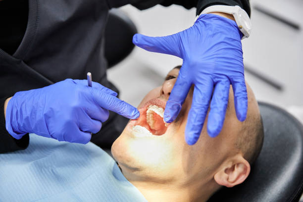 Best Emergency Gum Treatment in Bayonne, NJ