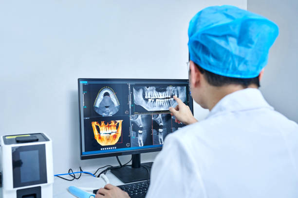 Best Urgent Care for Lost Fillings or Crowns in Bayonne, NJ